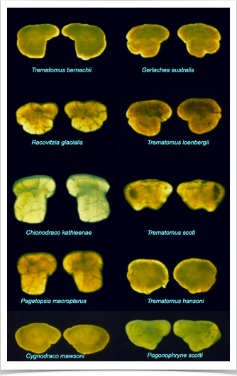 Preparation of Notothenioid Fish Otolith Atlas for predator-prey interrelationship research in the Southern Ocean around Antarctica.